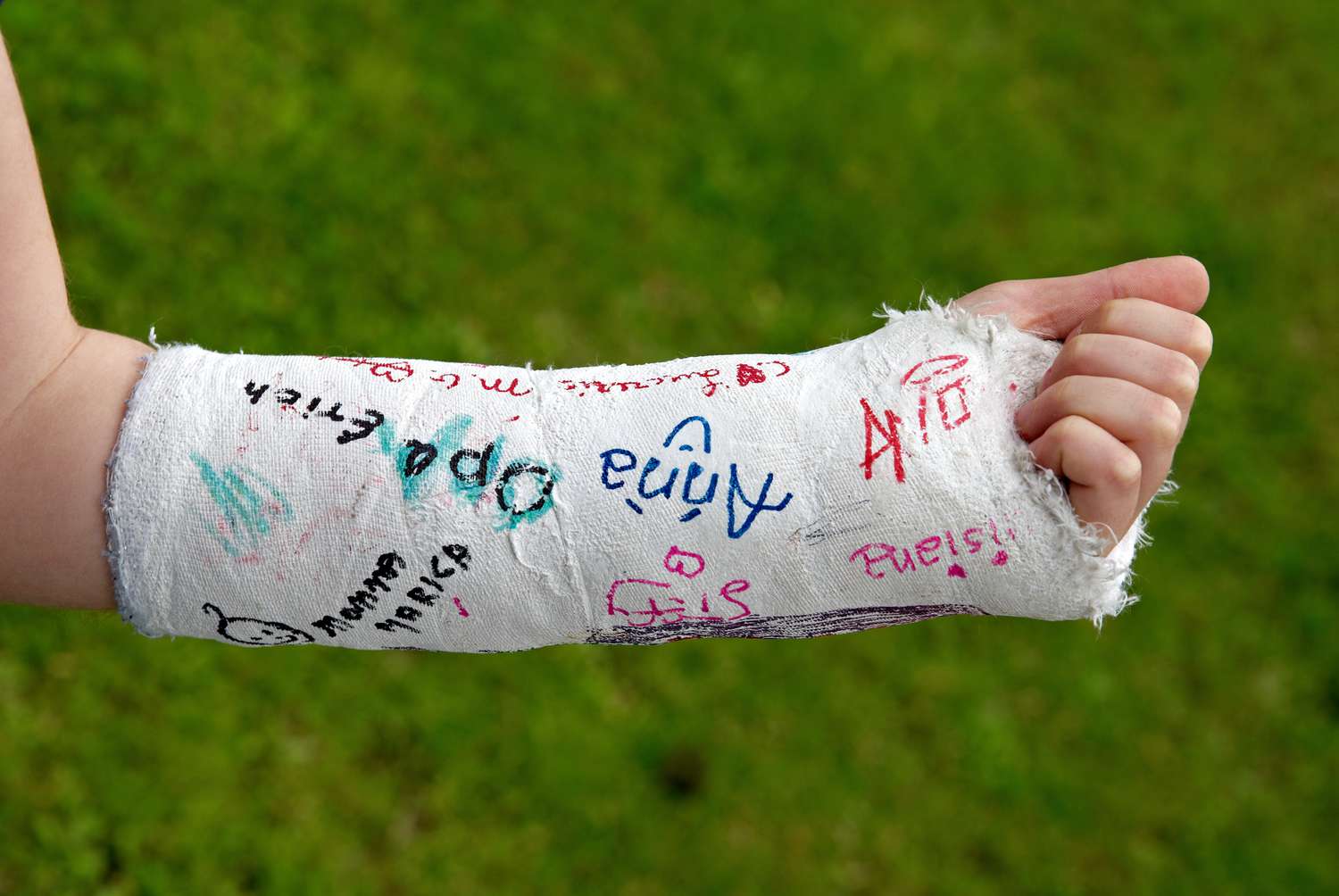 A forearm in a white plaster cast covered with colorful signatures and doodles in red, blue, black, and pink ink, against a blurred green grass background. The hand is clenched into a fist.